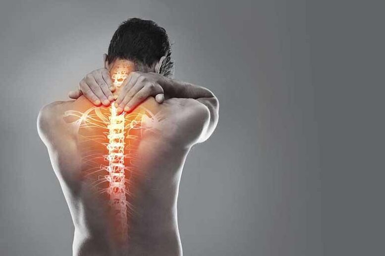 A méhnyakos régió osteochondrosis