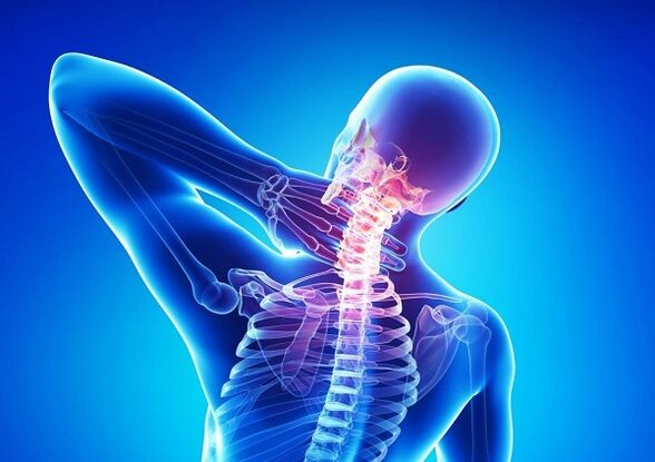 Fájdalom a nyaki gerincben osteochondrosissal