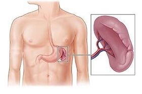 a lép patológiája, mint a bal lapocka alatti fájdalom oka