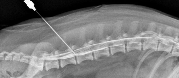 a gerinc blokádja osteochondrosissal